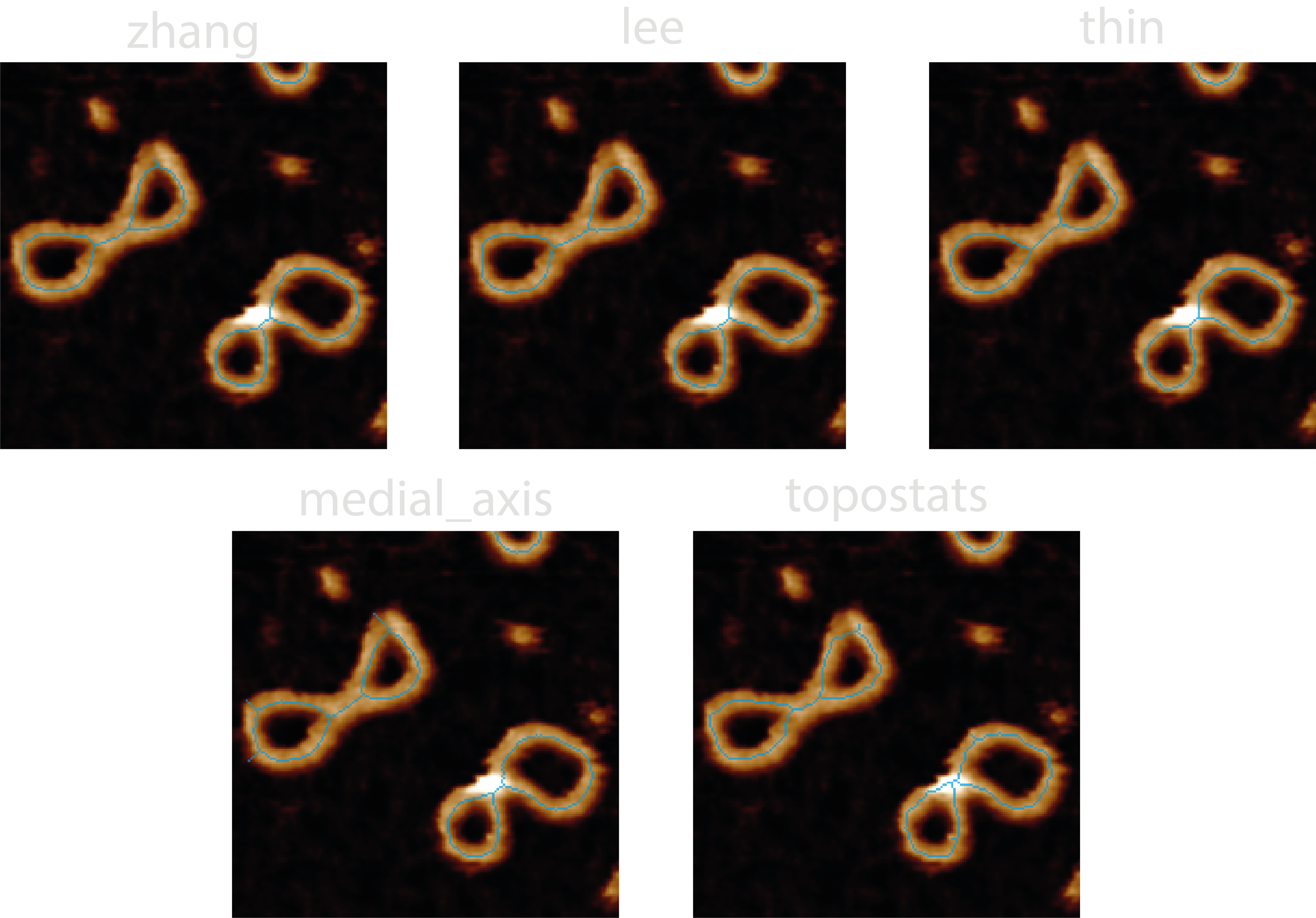 Comparison between skeletonisation algorithms