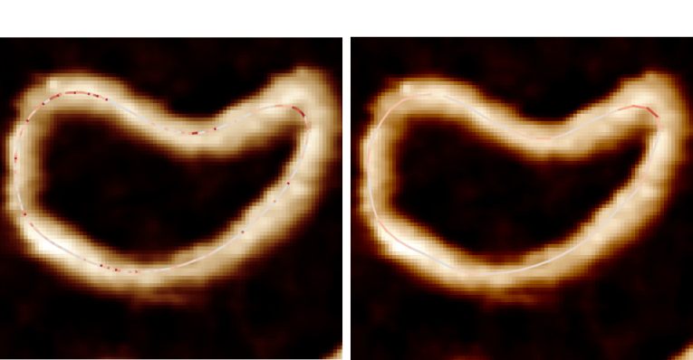example of curvature using unevenly spaced trace coordinates